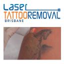 Laser Tattoo Removal Brisbane  logo
